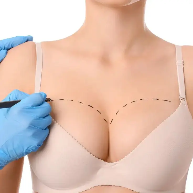 Breast Plastic Surgery